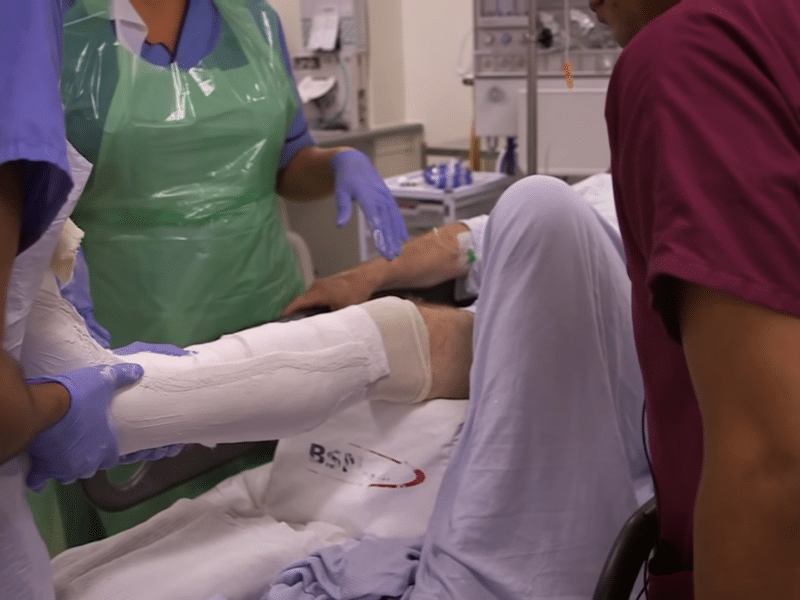 Video: Patient med brækket ankel har det for fedt på Ketamin