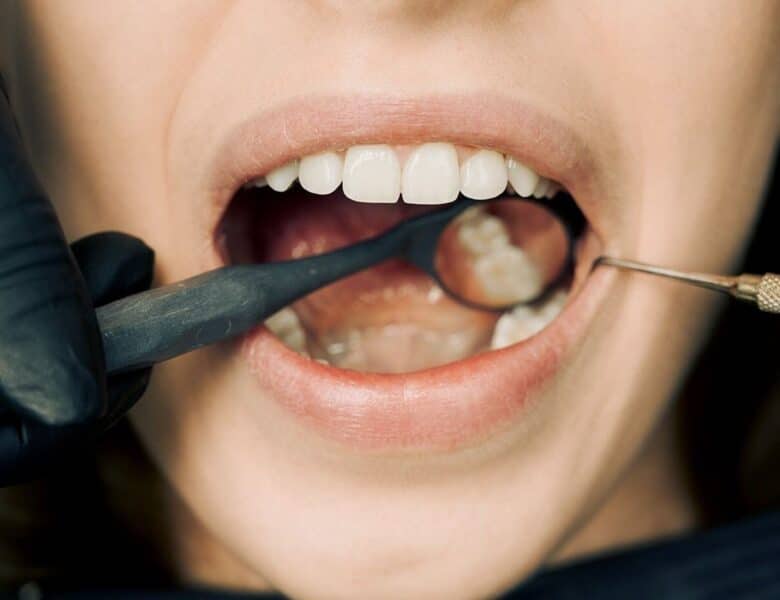 Hvordan man vælger den rigtige tandlæge